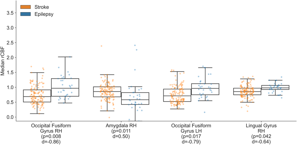 Discriminating Distal Ischemic Stroke from Seizure-Induced Stroke Mimics Using Dynamic Susceptibility Contrast MRI
